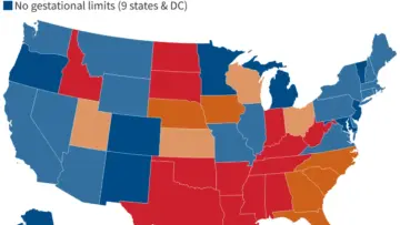 U.S. Abortion Rates Reach Over One Million in 2025 Despite Expanding State Restrictions and Bans, New Data Shows